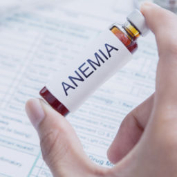 icd 10 Codes, Treatment of Anemia, Symptoms of Anemia, anemia signs, aplastic anemia