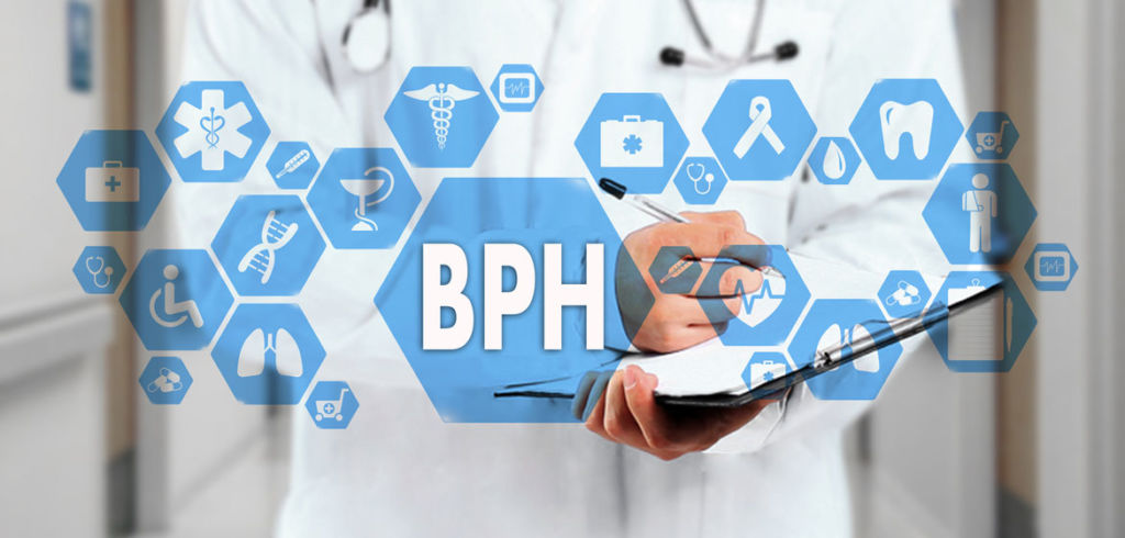 Benign prostatic hyperplasia, Treatment for BPH, ICD-10 Codes for BPH, Nodular prostate, Symptoms of BPH, BPH Benign