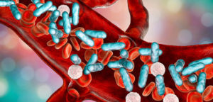 ICD-10 codes for Sepsis, Symptoms of Sepsis, Treatment for Sepsis, treatment sepsis, cause of sepsis, medication of sepsis