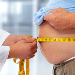 Causes of Obesity, Treatment for Obesity, ICD-10 codes for obesity