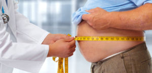 Causes of Obesity, Treatment for Obesity, ICD-10 codes for obesity