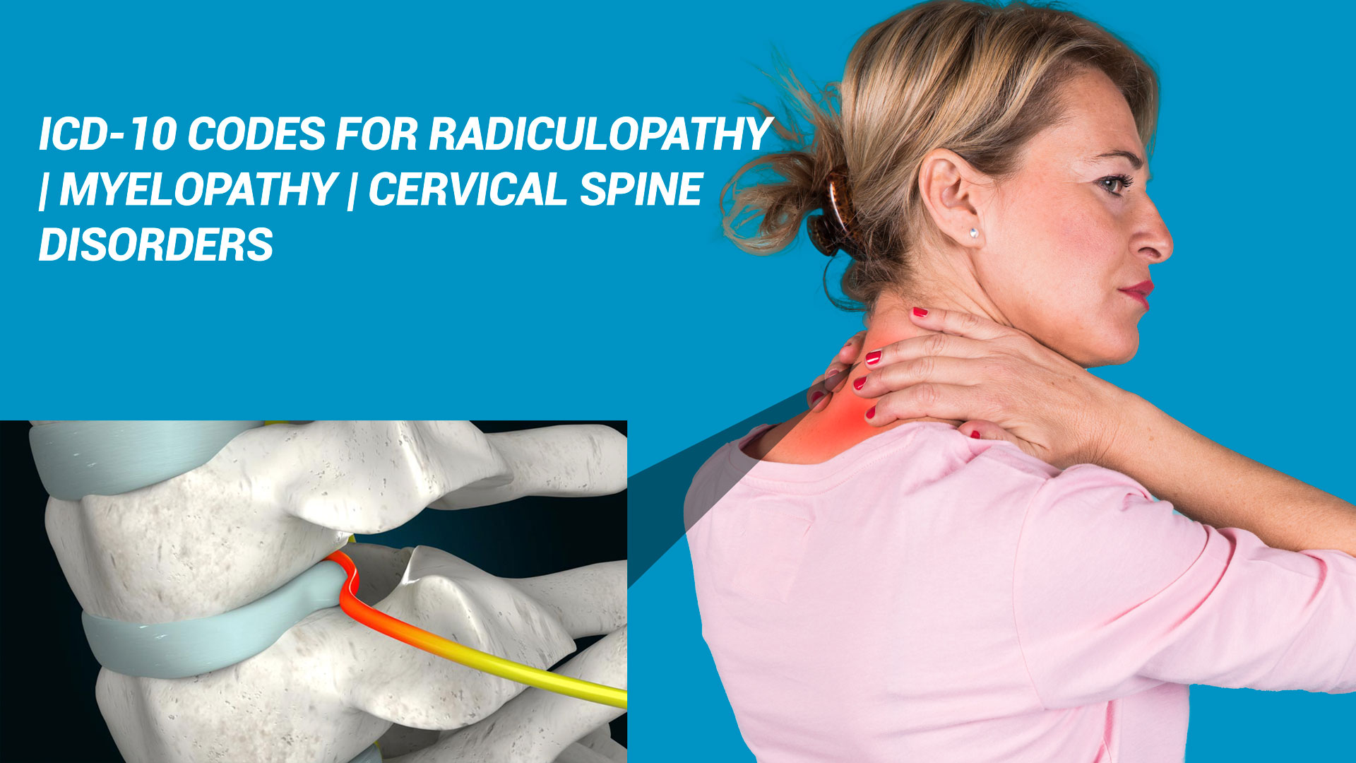 ICD-10 Codes For Radiculopathy | Myelopathy | Cervical Spine Disorders